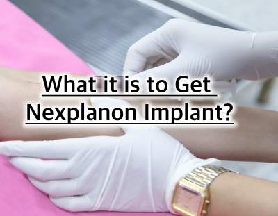 Nexplanon Implant